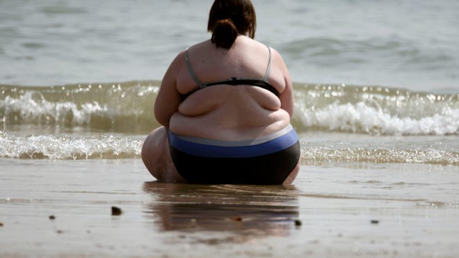 obesity beach